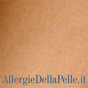 Allergie della pelle